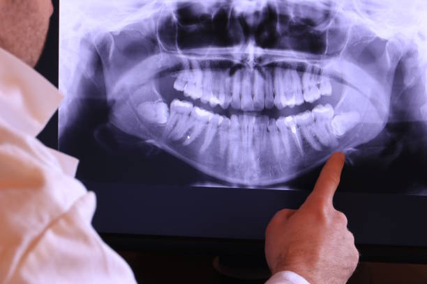 Best Emergency Dental Extractions in Flushing, MI