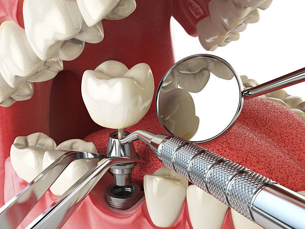 Best Weekend Emergency Dentist in Flushing, MI